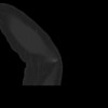 SPORK, NICO - 22.03.1976 - 02.08.2022 - CT obere Extremität - 18:01:46
